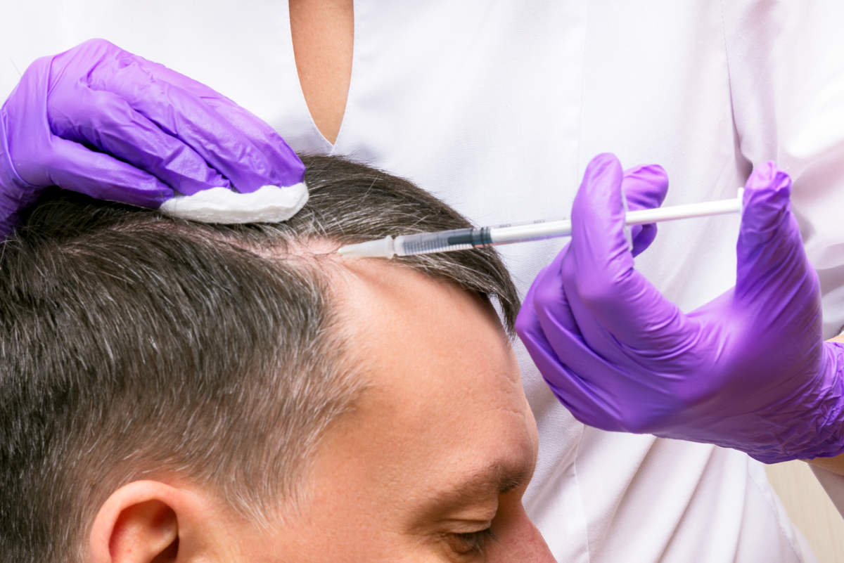 Injection, Treatment for Hair Loss | Botox For Hair Loss: Can Botox Treat Alopecia In Men? | hyaluronic acid